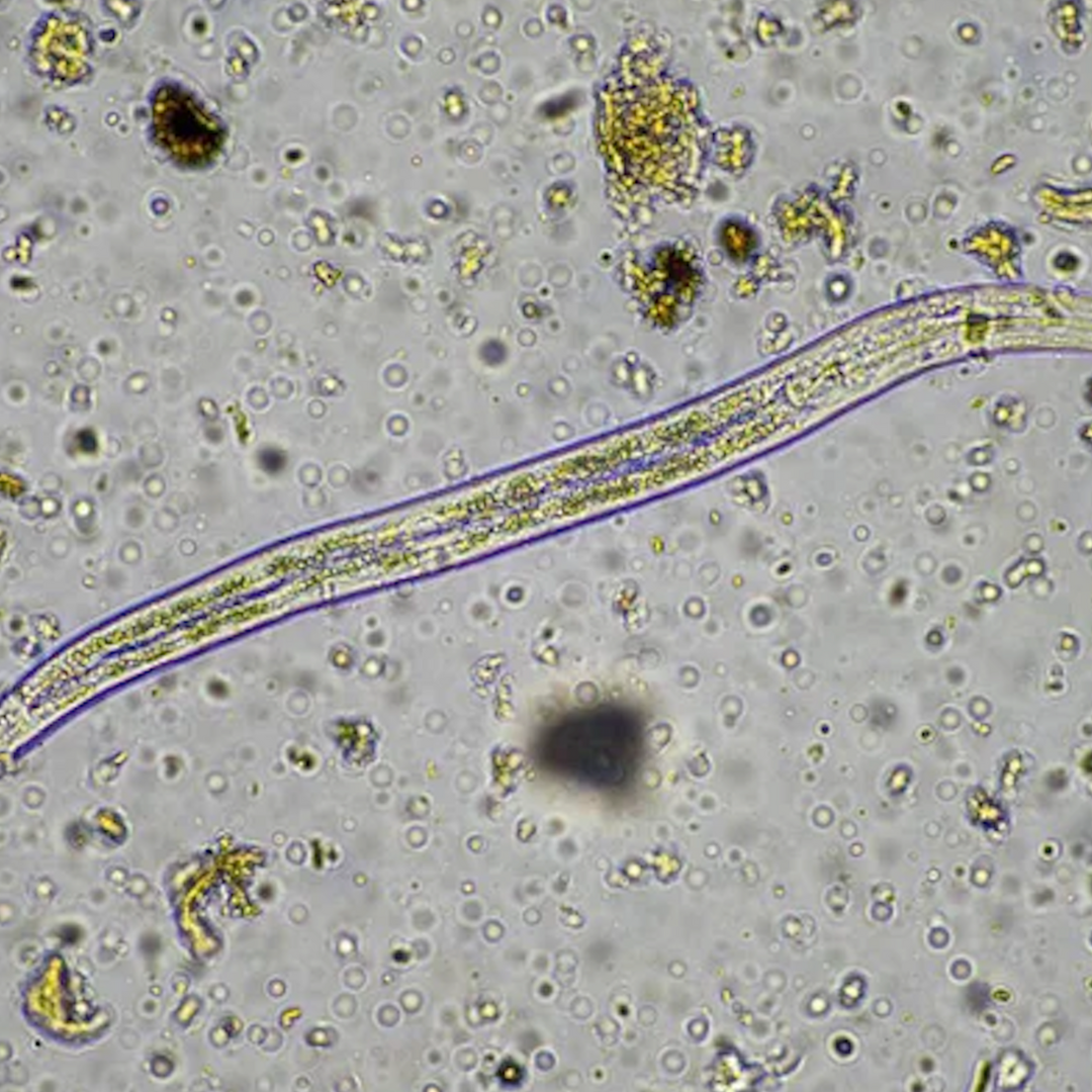 Representação de parasitas ocultos no organismo - vermes, fungos, bactérias e vírus