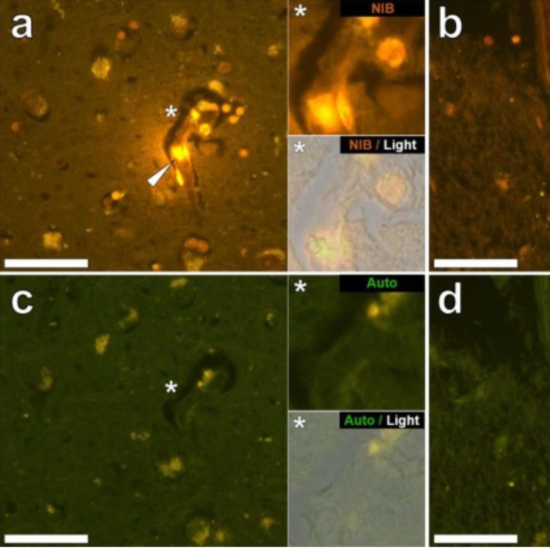 Toxinas ambientais e metais pesados - mercúrio, chumbo, alumínio e agrotóxicos